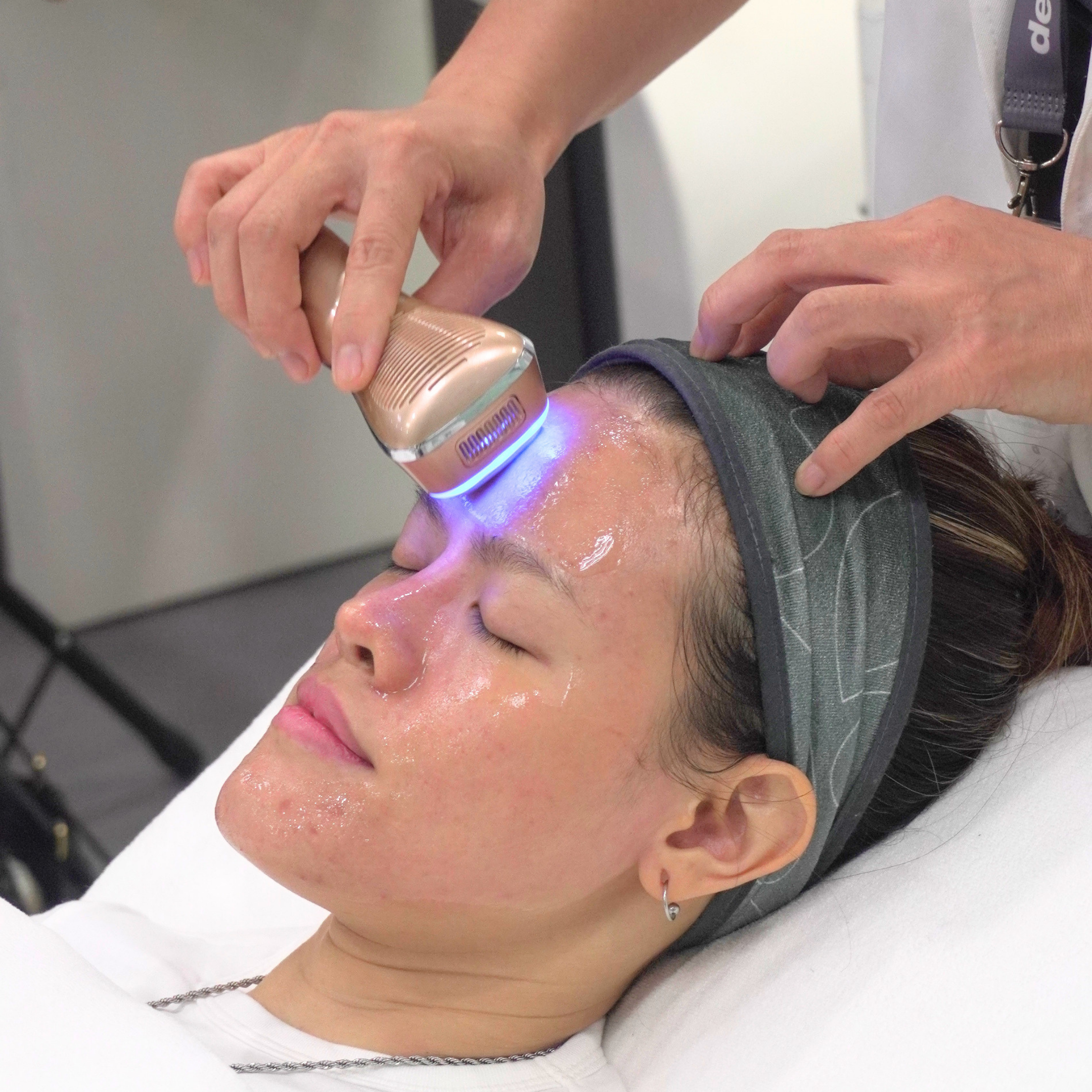 Liệu pháp Kiểm soát mụn & tái tạo da