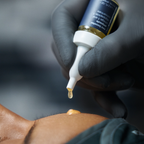 exo booster x microneedling