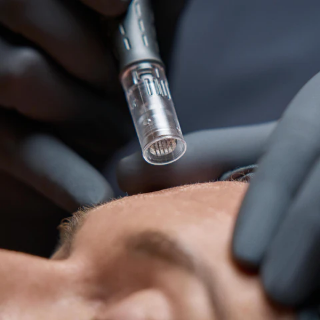 pro microneedling
